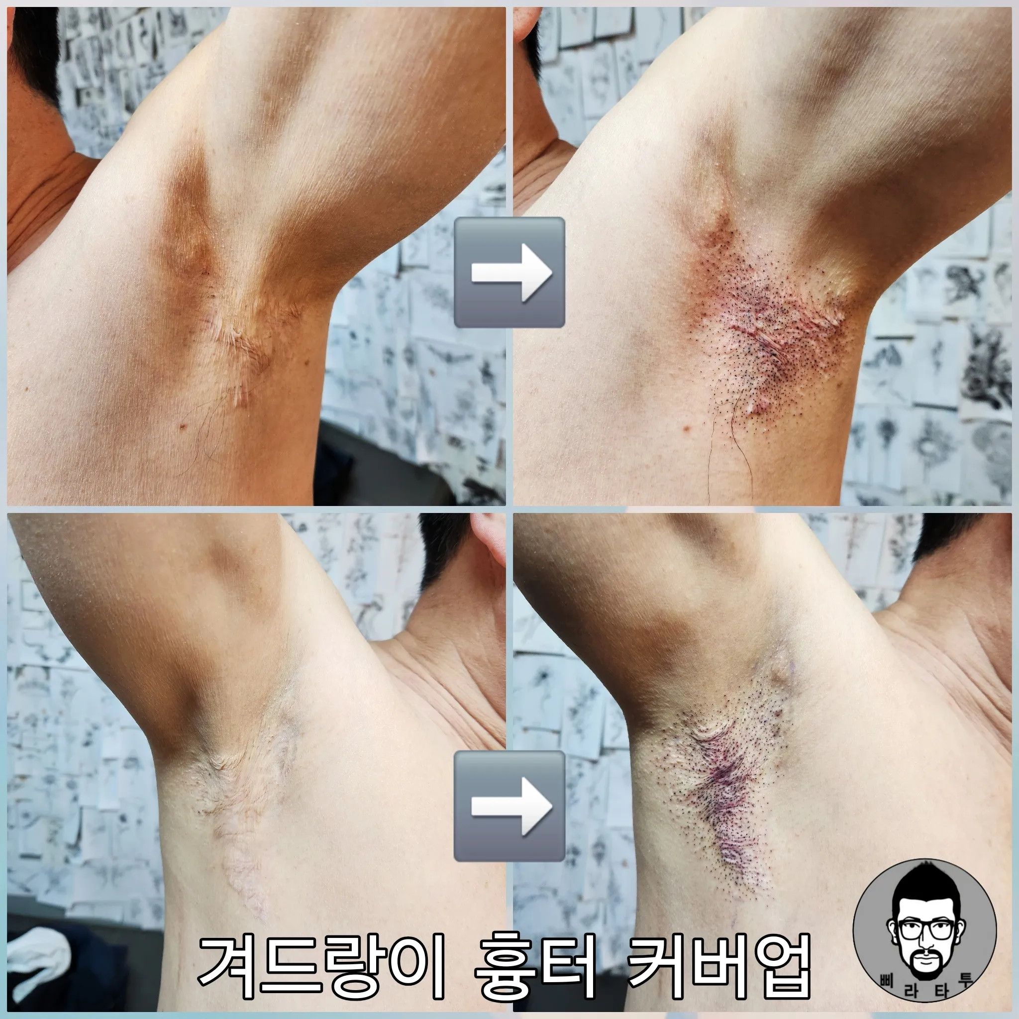 ๋ผ์ธ์ํฌ ๊ฒจ๋๋์ด ํํฐ์ปค๋ฒ์
ํํฌ