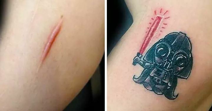 자연스러운 커버업 타투로 흉터를 감추다