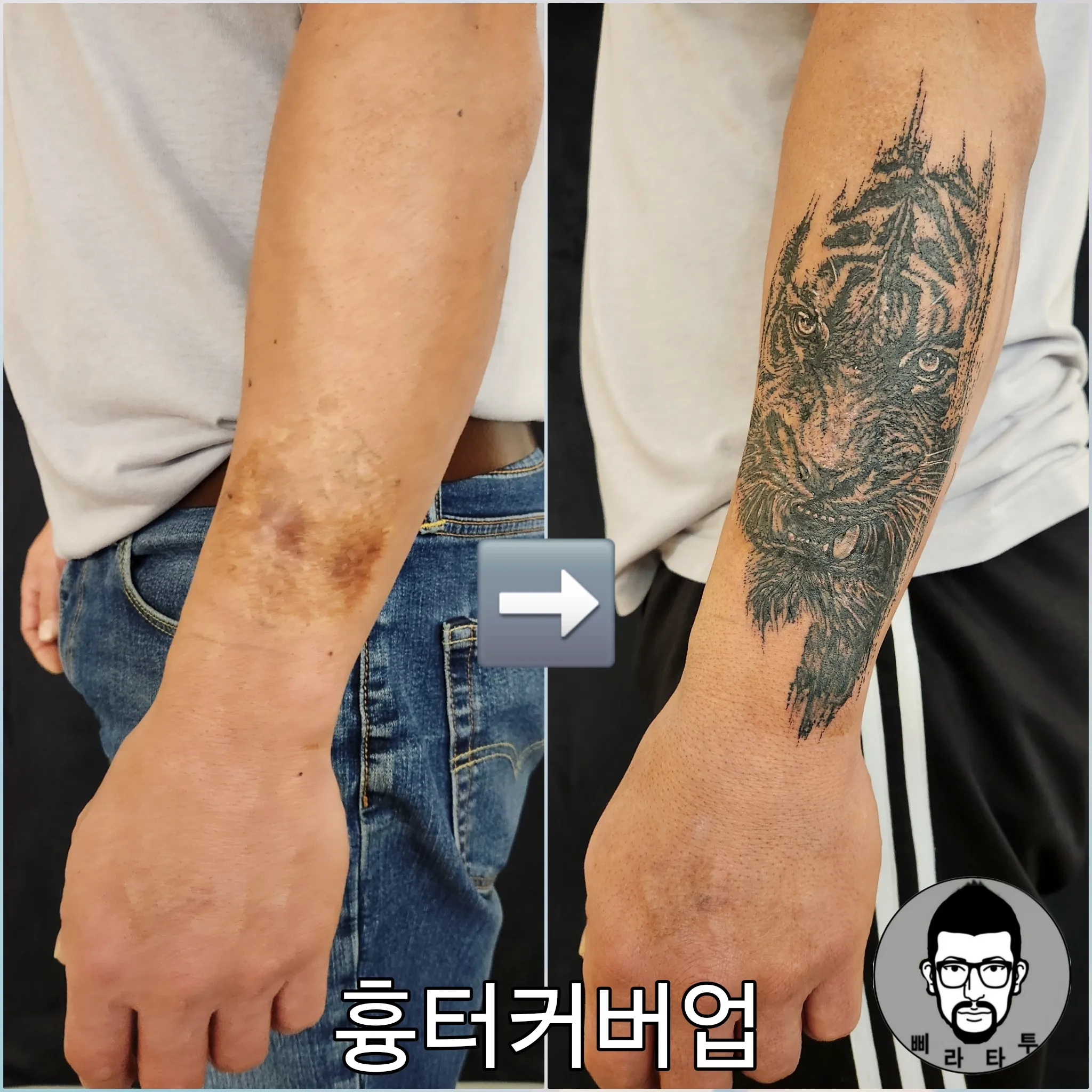 블랙워크 흉터 커버업 타투: 호랑이 디자인
