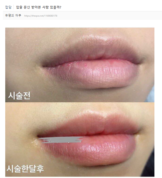 ์
์ ํํฌ: ์์ฐ์ค๋ฌ์ด ์๋ฆ๋ค์์ ์์ฑ