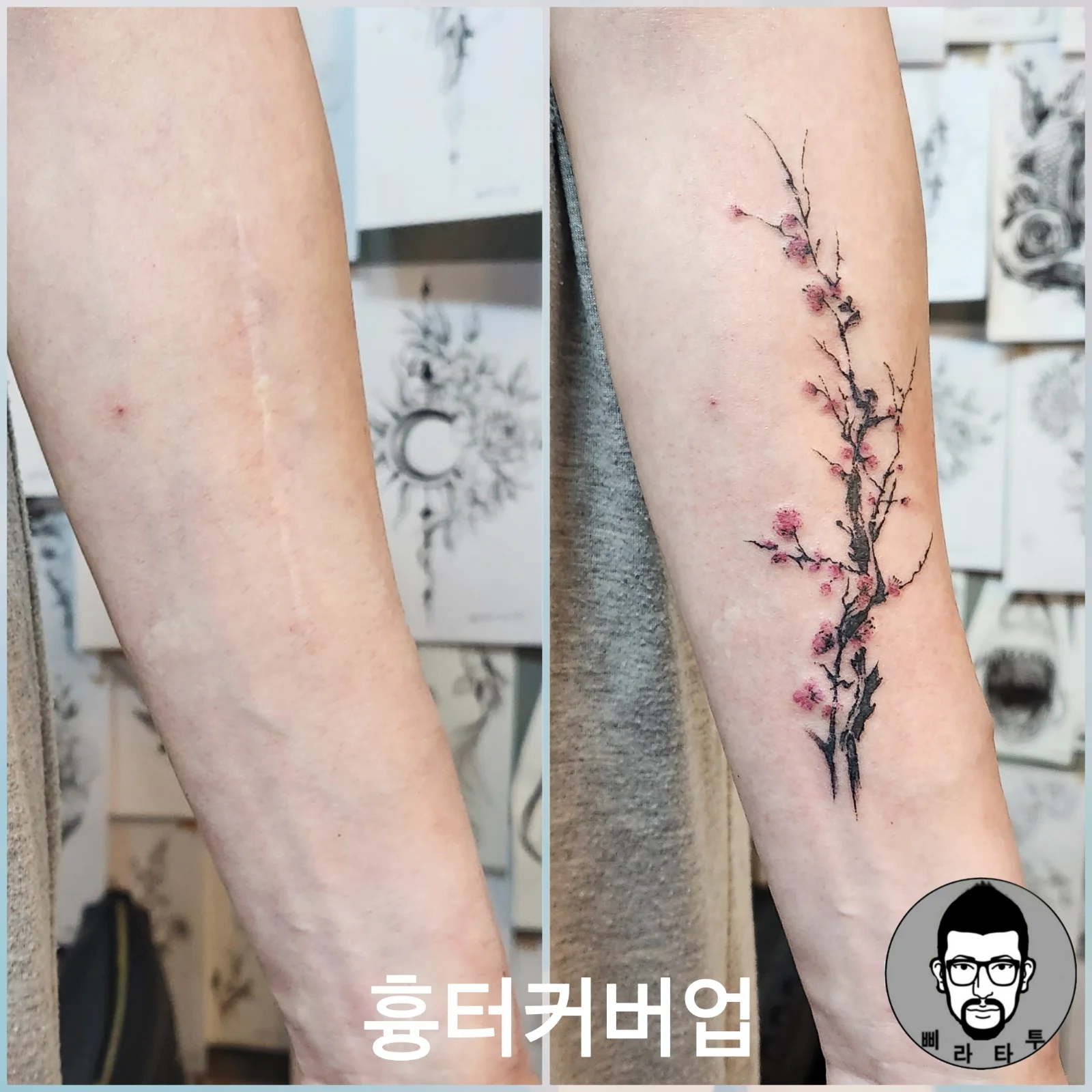 매화 흉터 커버업 작품 소개