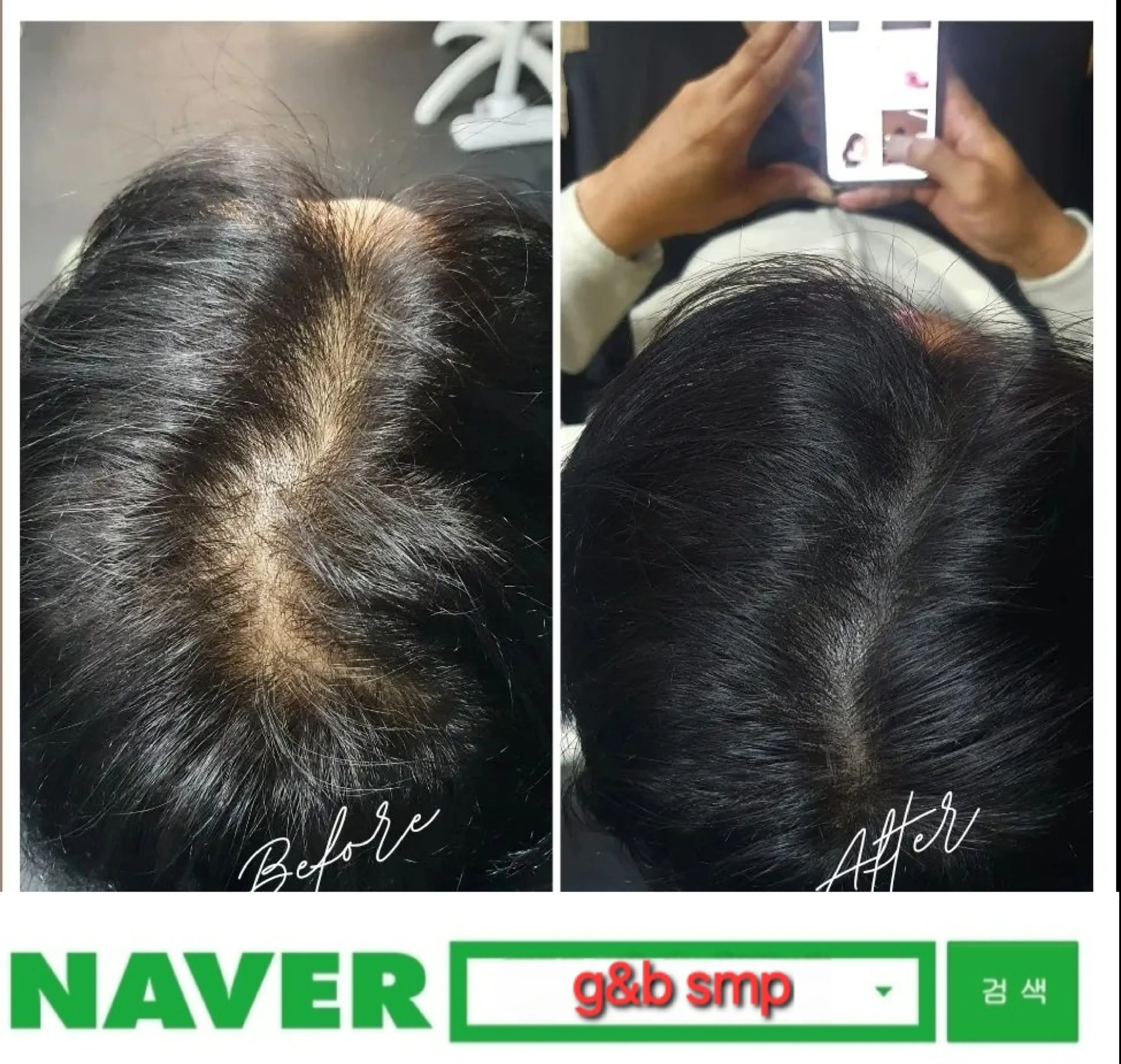 블랙앤그레이 스타일 두피문신: 가르마